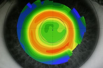 Ets miop? Això et pot interessar