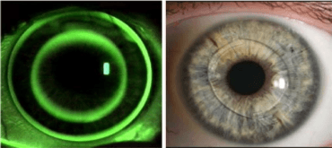 Màster en Optometria i Ciències de la Visió